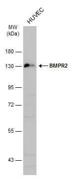 Perforin Rabbit Polyclonal Antibody