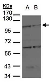 BMPR2 antibody