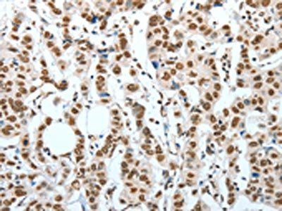BNIP1 Antibody