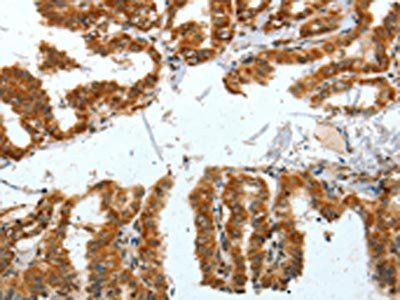 BNIP1 Antibody