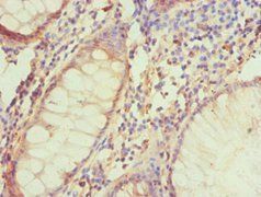BNIP3L Antibody