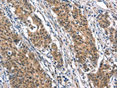 BNIP3L Antibody