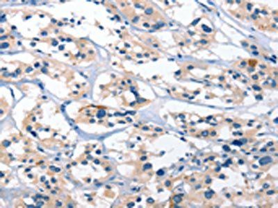 BNIP3L Antibody