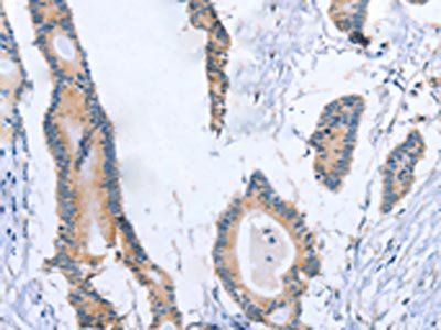 BOD1 Antibody