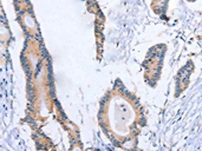 BOD1 antibody