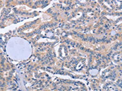 BOD1 Antibody