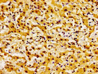 BOK Antibody