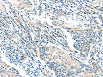 BOK Antibody