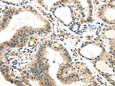 BOK Antibody