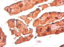 BMP3 Antibody