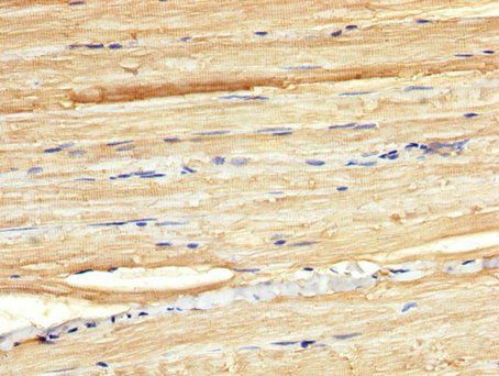 BORA Antibody