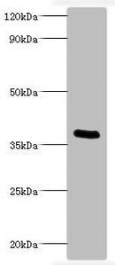 Bordetella pertussis Pertussis toxin subunit 1 antibody