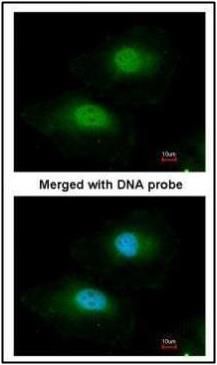 BPGM antibody [N1C3]