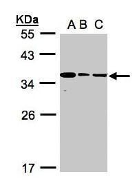 BPGM Rabbit Polyclonal Antibody