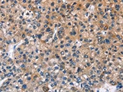 BPI Antibody