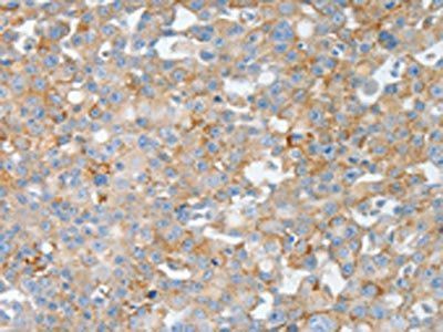 BPIFB2 Antibody