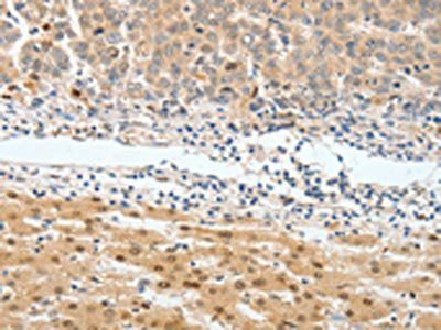 BPIFB2 Antibody