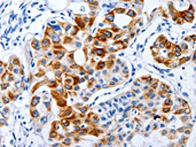 BPIFB3 antibody