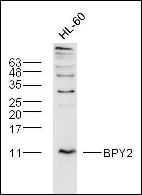 BPY2 antibody