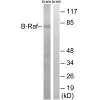 BRAF (Ab-753) antibody