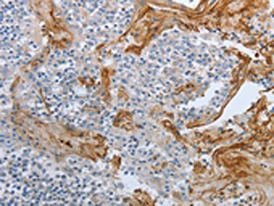 BRAF Antibody
