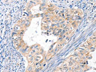 BRCA1 antibody