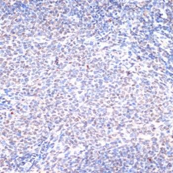 BRCA1 (Phospho-S1423) antibody