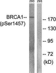 BRCA1 (phospho-Ser1457) antibody