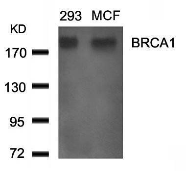 BRCA1 (Ab524) Antibody