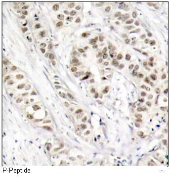 BRCA1 (Phospho-Ser1524) Antibody