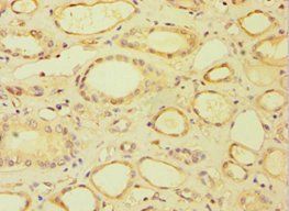 BRCC3 Antibody