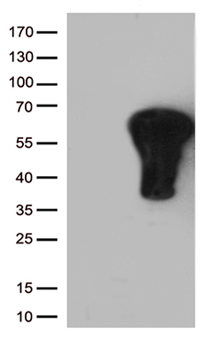 BRCC36 (BRCC3) antibody