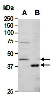 BRCC3 antibody