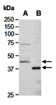 BRCC3 (N) Antibody, Rabbit Polyclonal
