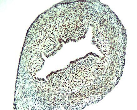 BrdU (Proliferation Marker) Rabbit Polyclonal Antibody