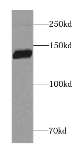 Brevican antibody