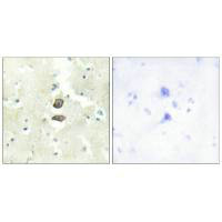 BRI3BP Antibody