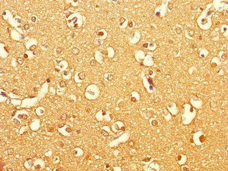 BRINP1 Antibody