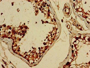 BRIP1 Antibody