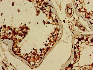 BRIP1 antibody