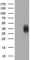 BRIT1 (MCPH1) antibody