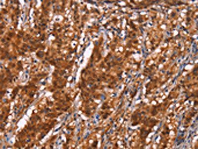 BRK1 Antibody