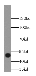 BRN2-Specific antibody