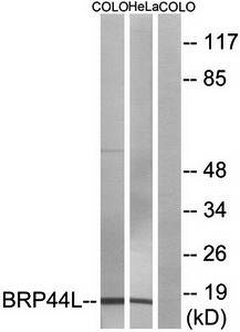 BRP44L antibody