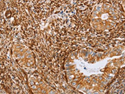 BRS3 Antibody
