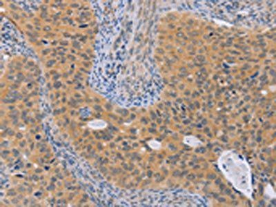 BRS3 Antibody