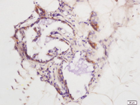 MIP1 alpha antibody