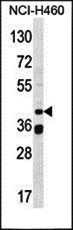 BSCL2 antibody