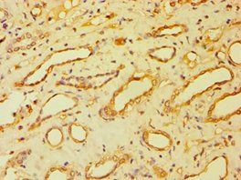BSND Antibody