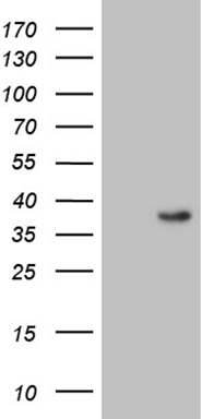 BTBD3 Antibody